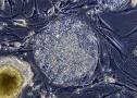 stemcells